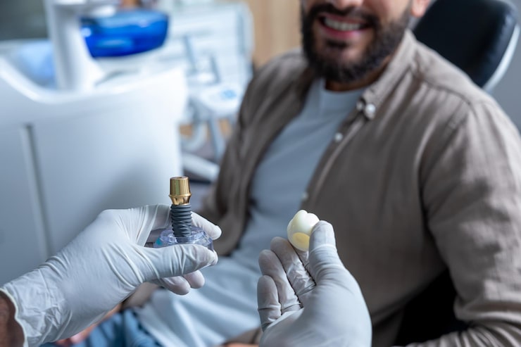 Dental implants Hudson NH